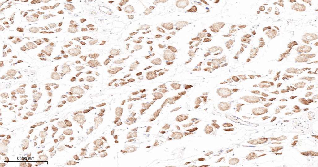 人丙酮酸脱氢酶激酶亚型2即用型免疫组化试剂盒-IHC0692H